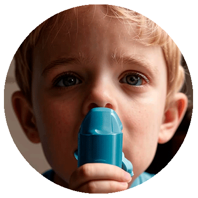 Бронхиальная астма у детей: причины, симптомы и лечение